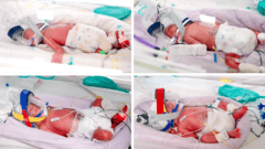 Rare identical quadruplets born in Australia